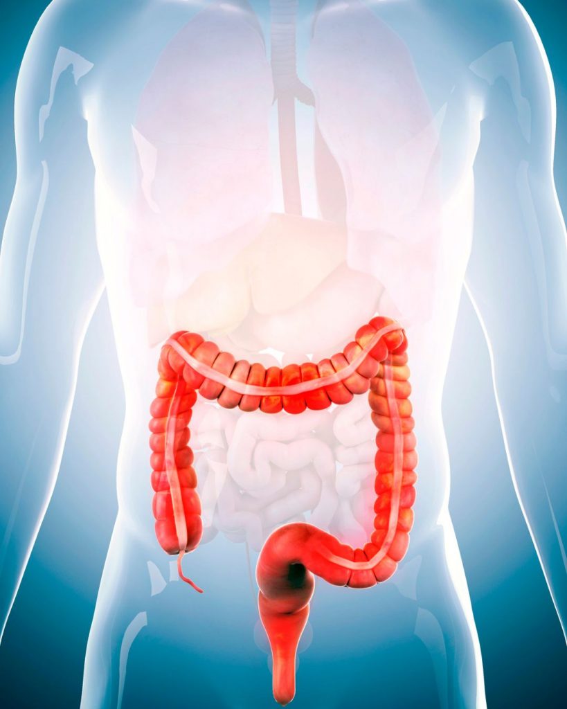 syndrom drazdiveho tracniku