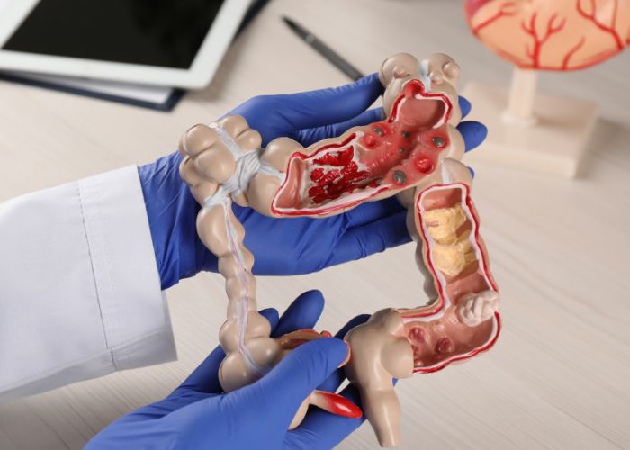 Nahaufnahme des Darms - dieser braucht nach einer Antibiotika-Einnahme Unterstützung