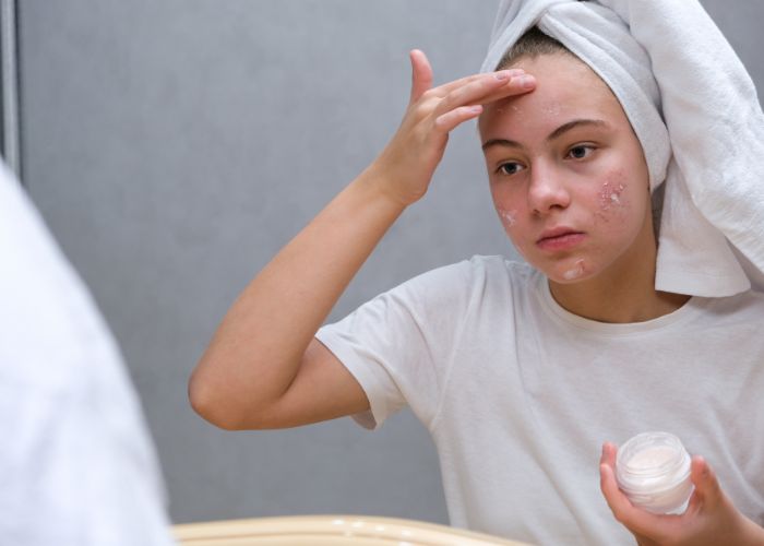 Hautprobleme - Mädchen schmiert sich Creme ins Gesicht