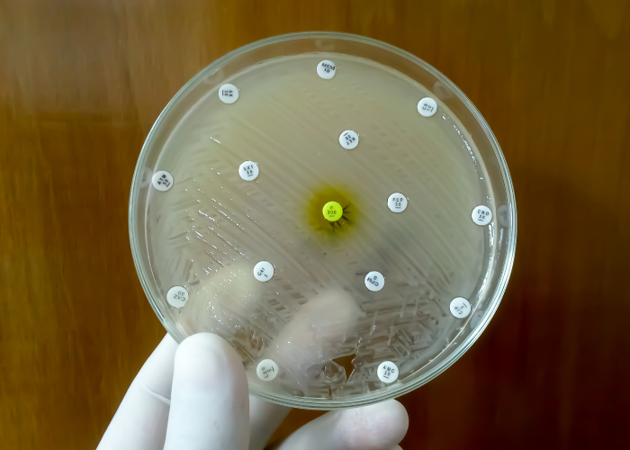 petrischale mit antibiotika und wachsenden bakterien deuten auf resistenzen hin