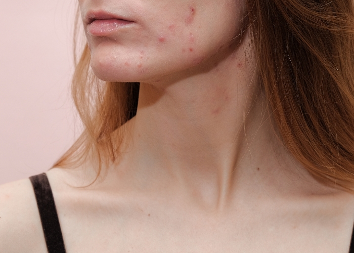 Frau mit Hautproblemen - was sind die Ursachen?