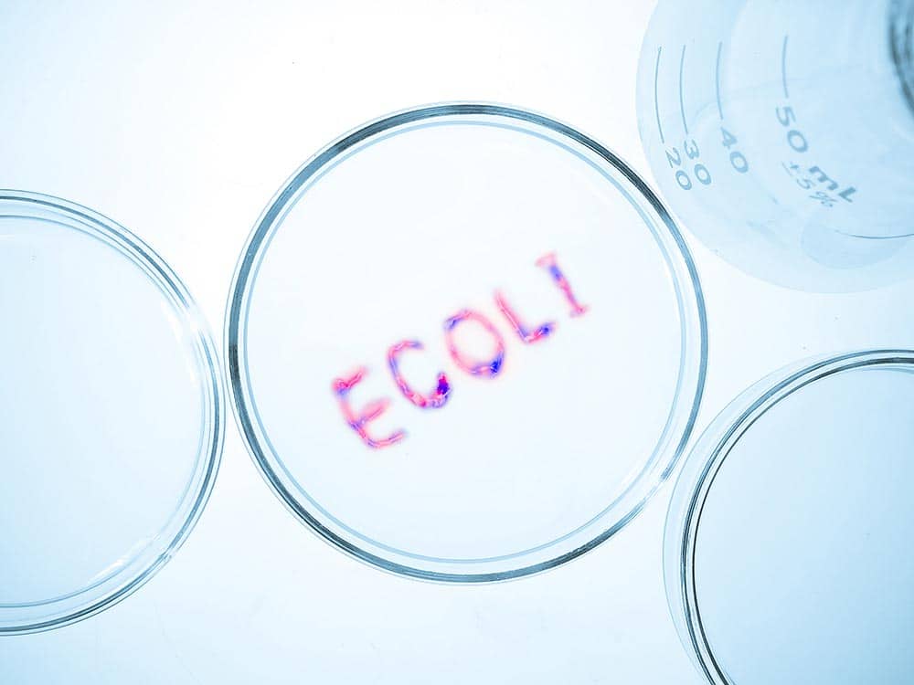 ecoli harnweg 4