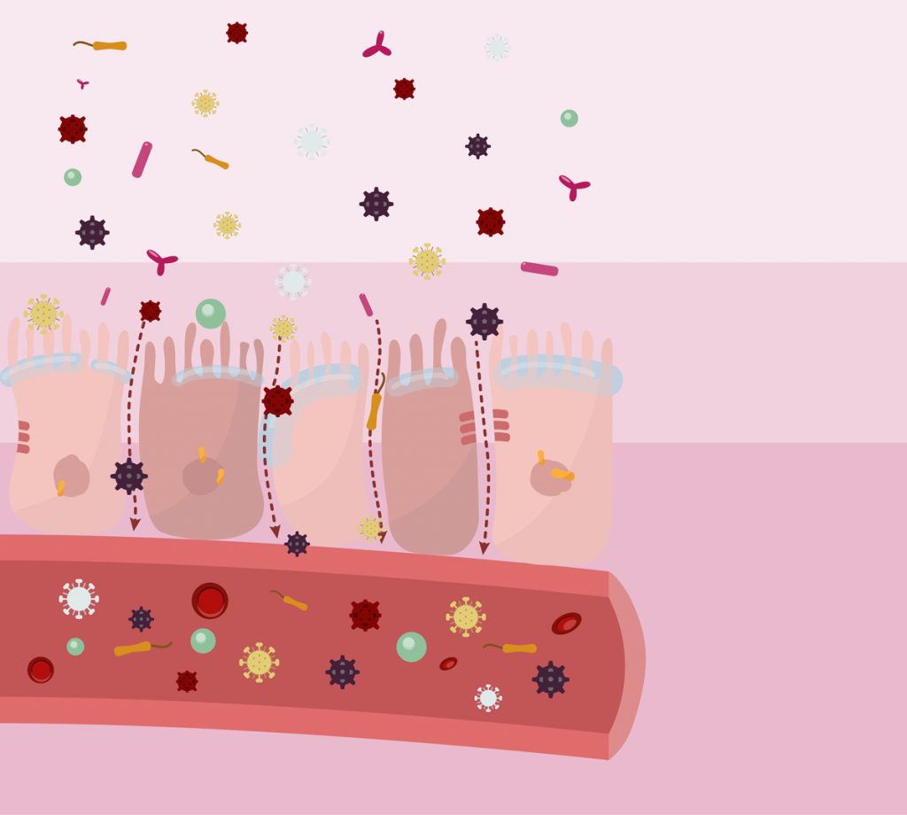 Abbildung aller drei Schichten einer kranken Darmbarriere