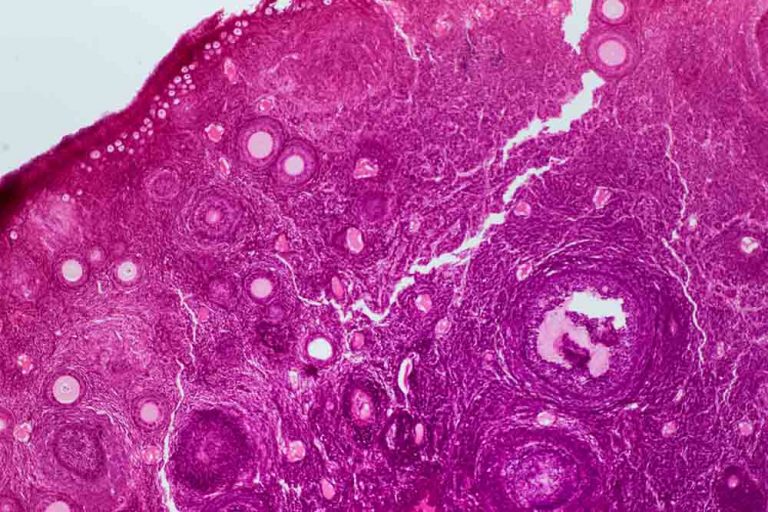 Querschnitt durch einen humanen Eierstock unter dem Mikroskop.