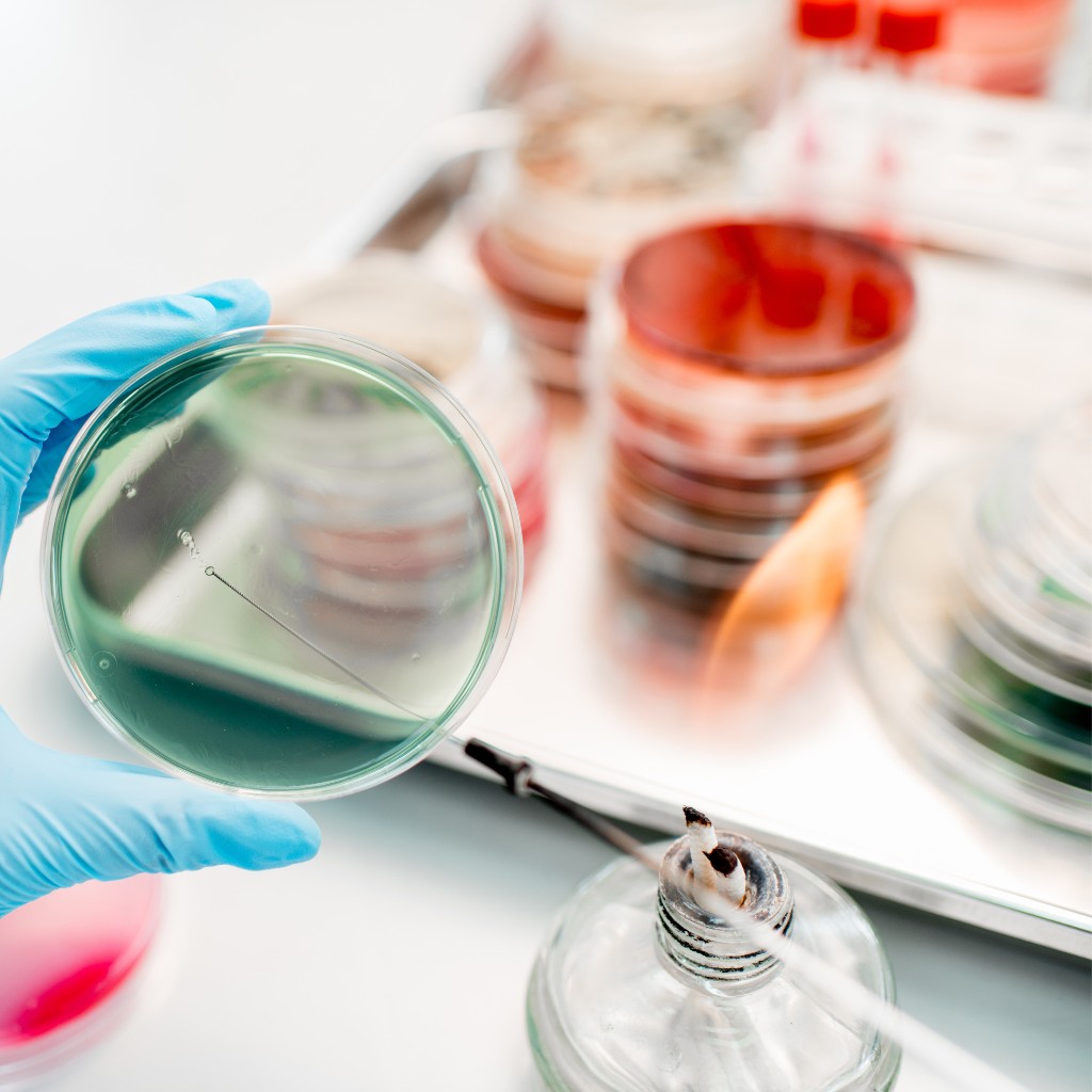 Petrischalen Beimpfung - Untersuchung des Mikrobiom im Labor