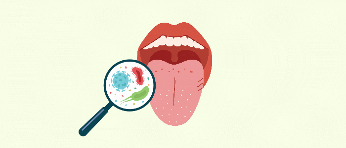 Bakterien im Mund die für Mundgeruch verantwortlich sein können