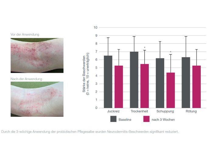 Studienergebnisse der Anwendung einer probiotischen Salbe