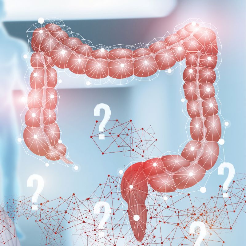 diagnosis of colitis crohns