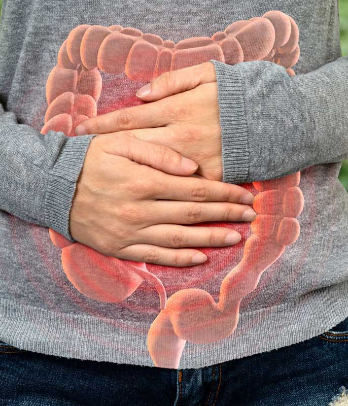 IBS flare up constipation diarrhoea