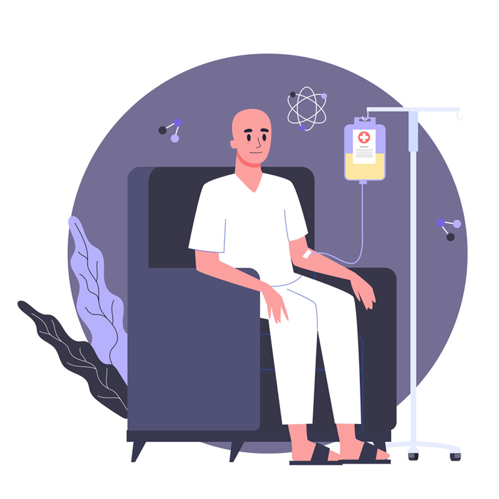 El estrenimiento como efecto secundario de la quimioterapia