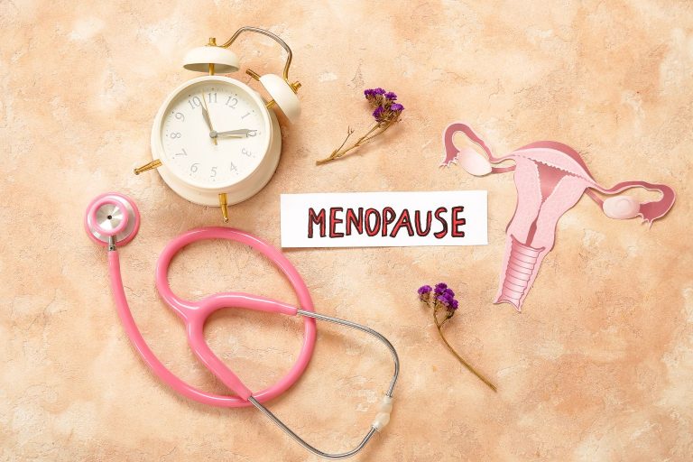 Menopausia