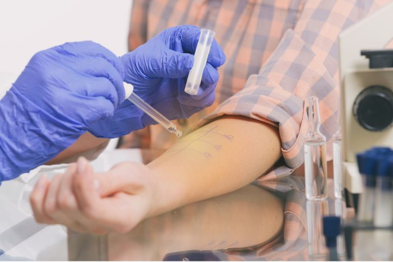 prueba médica para diagnosticar alergia mediante test cutáneo
