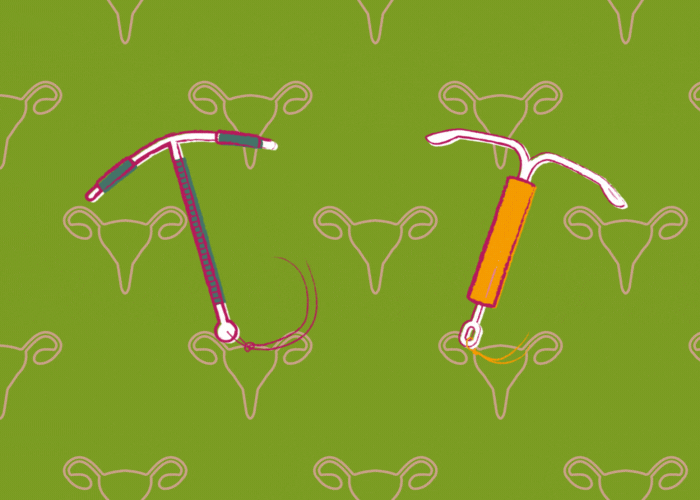 Impact des contraceptifs sur la flore intime - pilule et stérilet