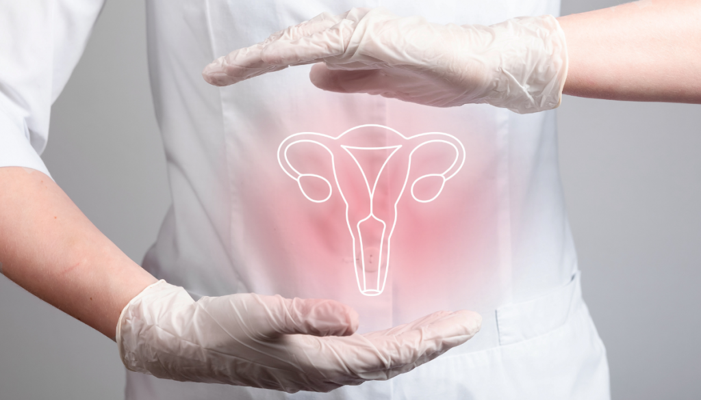 endometriose conseils