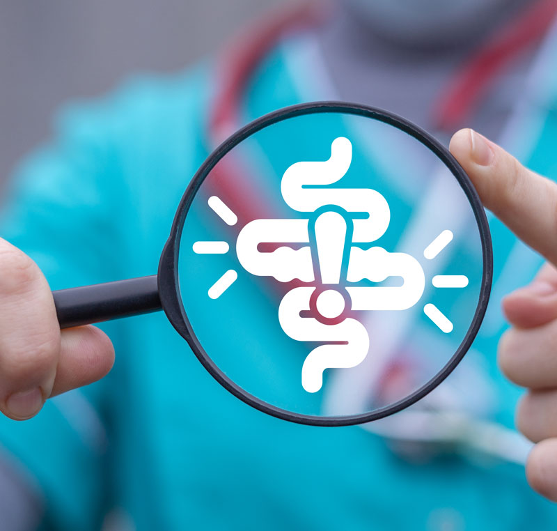 Les causes du syndrome de l'intestin irritable