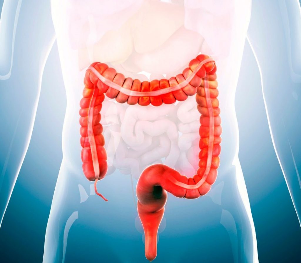 Le syndrome de l'intestin irritable : c'est quoi ?