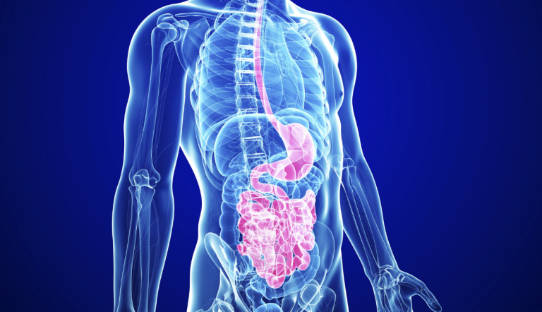 La maladie de Crohn : c'ets quoi ? Sympyômes et diagnostic