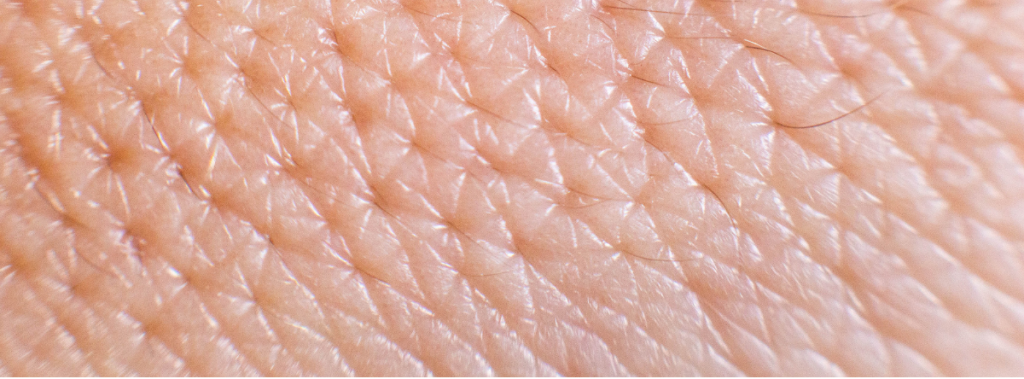 Le microbiote de la peau : des bactéries commensales