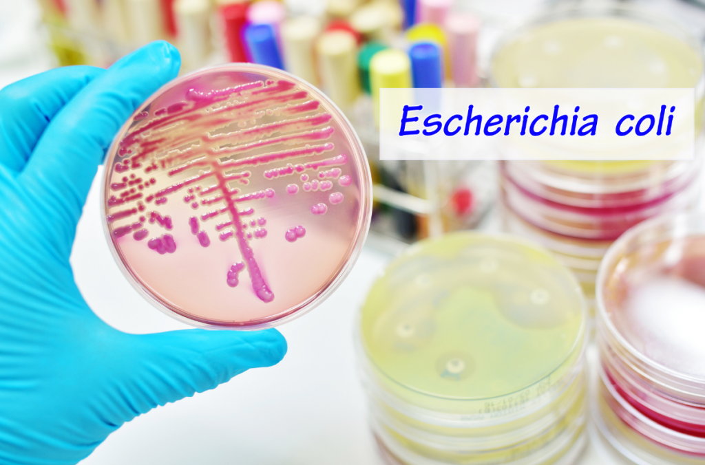 Infections urinaires : quand la protéine FimH aide la bactérie Escherichia Coli