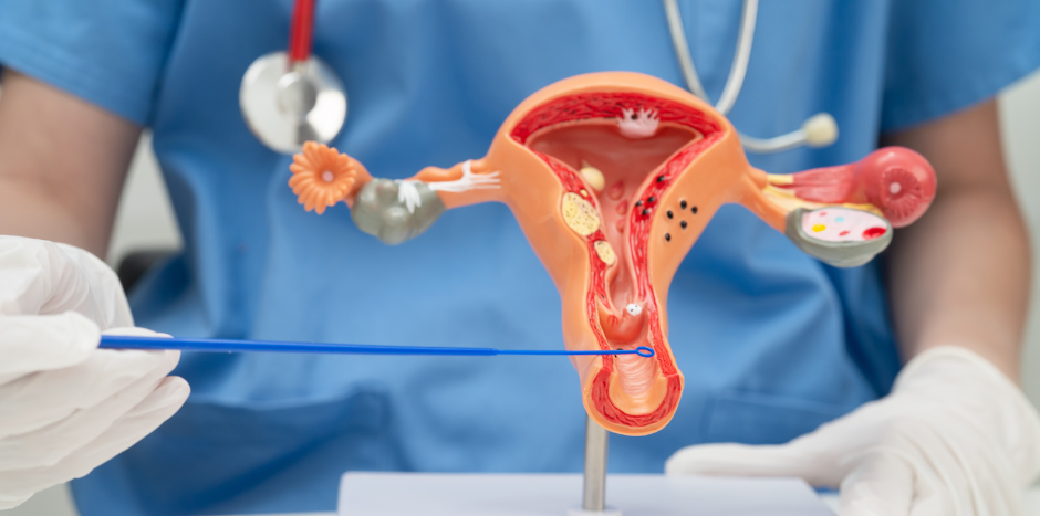 dysbiose vaginale