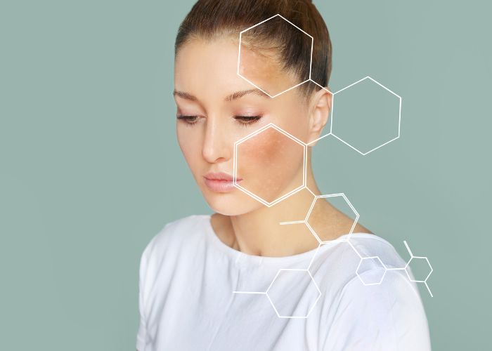 probiotici_contro_Acne