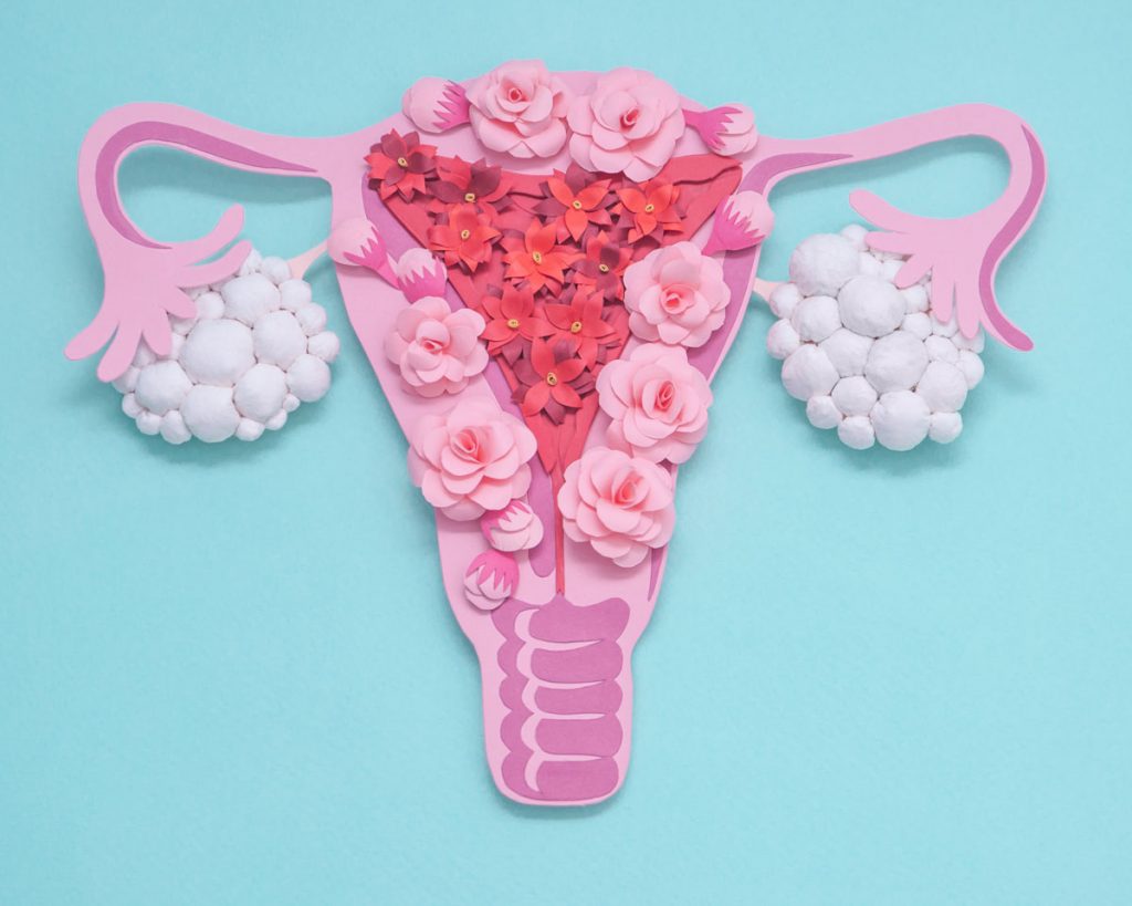 PCOS-sindrome-ovaio-policistico