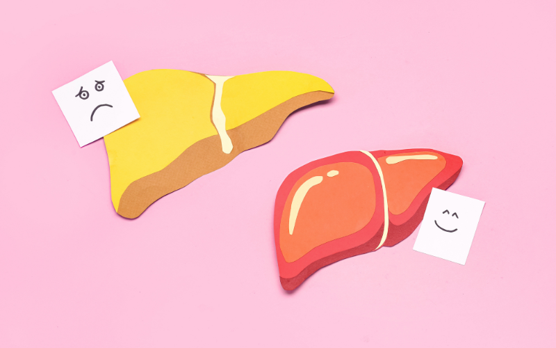 fegato-grasso-probiotici-zucchero-grassi