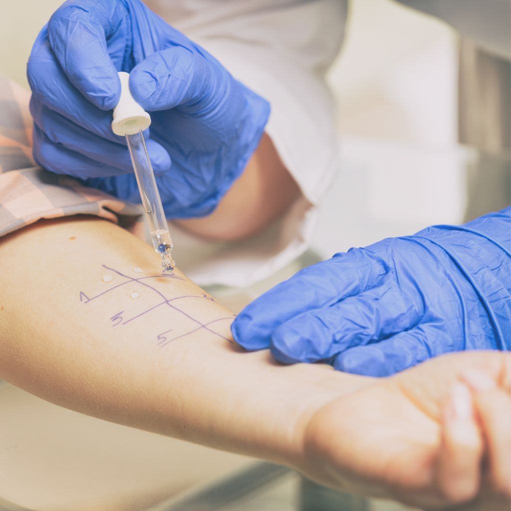allergy test prick test